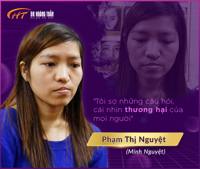 chỉnh hình mũi dị tật